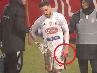 
	Reacția lui Niczuly, după accidentarea horror cu Dinamo: &quot;Mi-a pus degetul la loc, m-am temut&quot;
