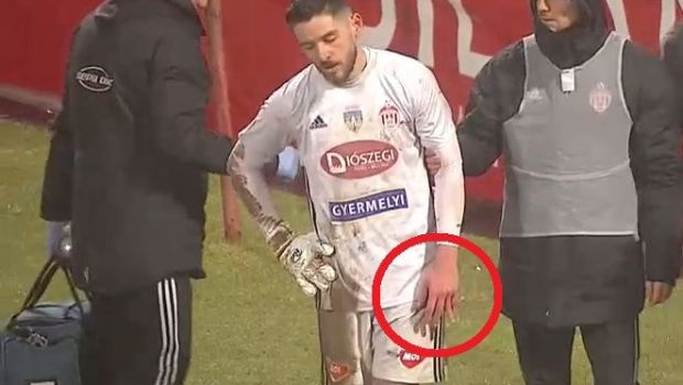 
	Reacția lui Niczuly, după accidentarea horror cu Dinamo: &quot;Mi-a pus degetul la loc, m-am temut&quot;
