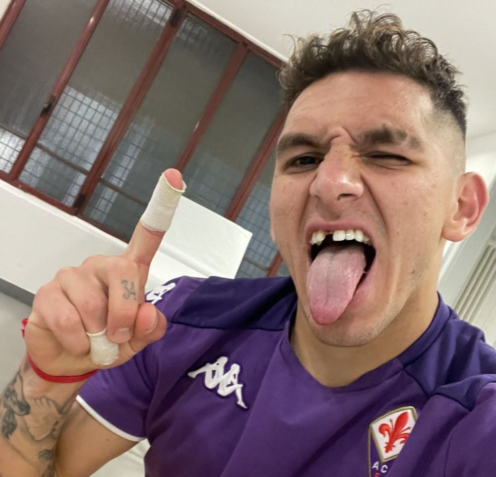 Un gol în plus, un dinte în minus! :) Lucas Torreira și-a scos singur dintele, la câteva minute după golul marcat pe San Siro_13