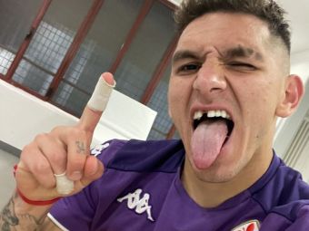 
	Un gol în plus, un dinte în minus! :) Lucas Torreira și-a scos singur dintele, la câteva minute după golul marcat pe San Siro
