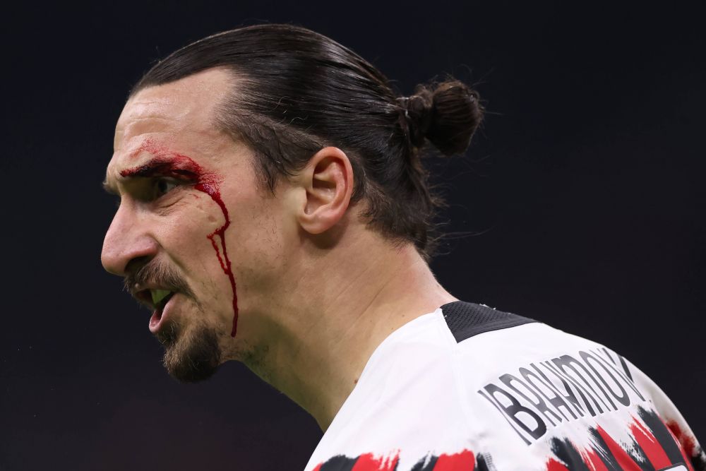 Zlatan Ibrahimovic, plin de sânge! Până să primească îngrijiri medicale, a avut ceva de împărțit de arbitrul_19
