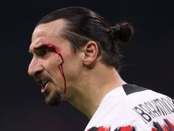 
	Zlatan Ibrahimovic, plin de sânge! Până să primească îngrijiri medicale, a avut ceva de împărțit de arbitrul
