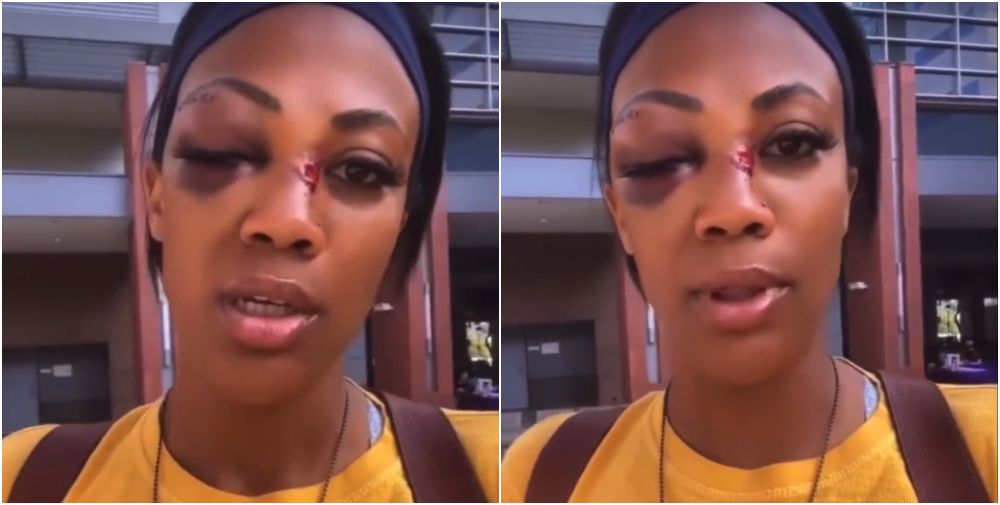 Imagini șocante! O vicecampioană olimpică, atacată cu brutalitate pe stradă! Sportiva a suferit mai multe fracturi _12