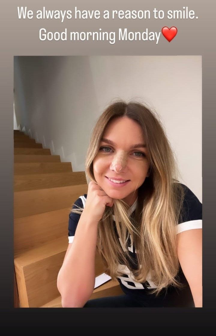 Simona Halep zâmbește! Prima fotografie cu tenismena din România după ce și-a dat jos bandajul în urma intervenției suferite _25