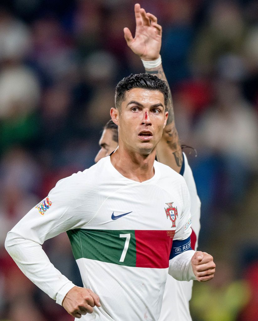 Imagini dure cu Cristiano Ronaldo! Fața i s-a umplut de sânge după o ciocnire cu portarul advers _18