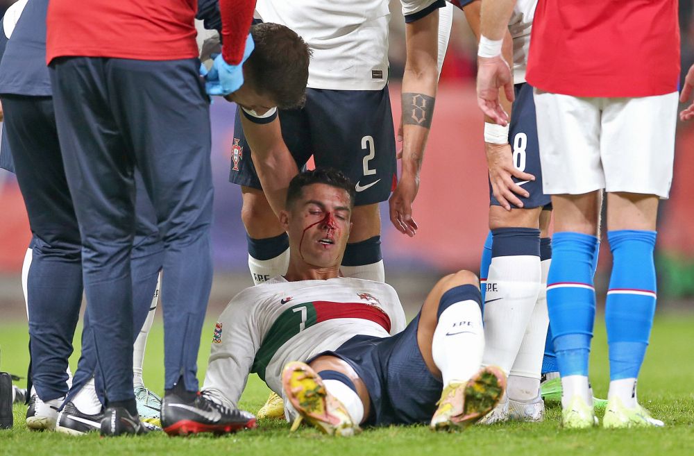 Imagini dure cu Cristiano Ronaldo! Fața i s-a umplut de sânge după o ciocnire cu portarul advers _7