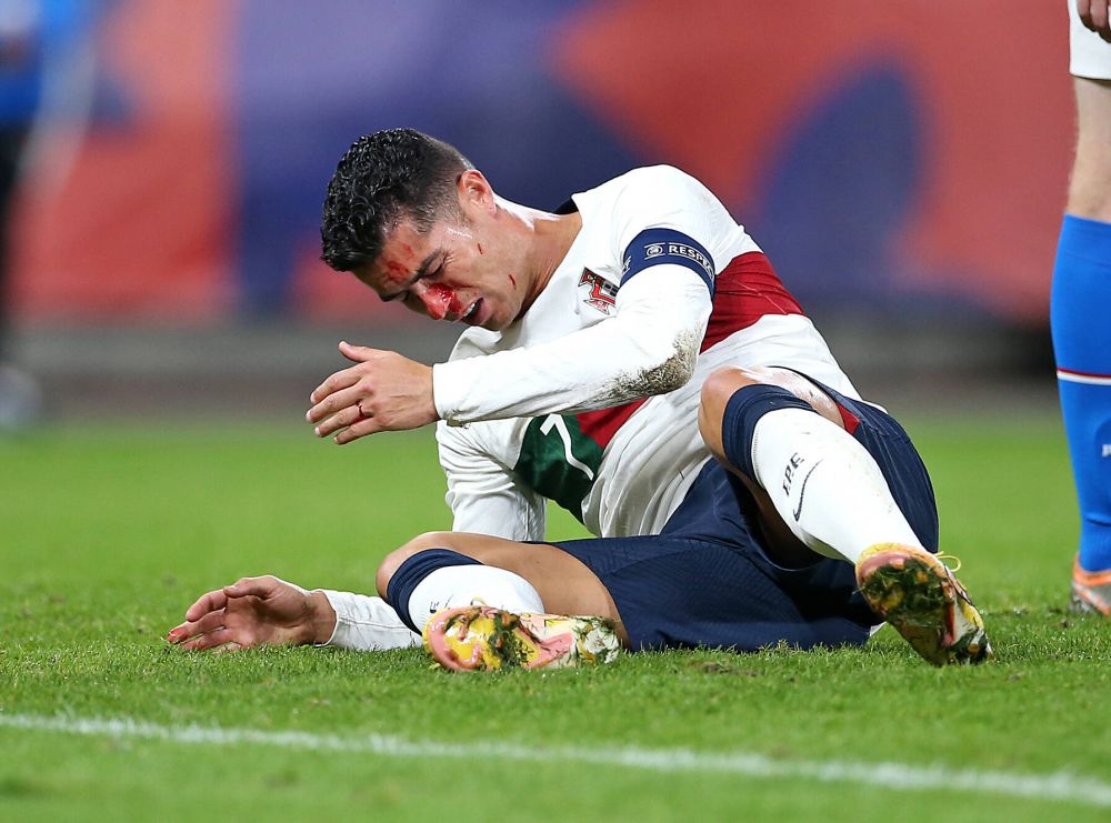 Imagini dure cu Cristiano Ronaldo! Fața i s-a umplut de sânge după o ciocnire cu portarul advers _8