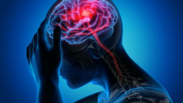 
	(P) Treptele durerii de cap. Câte faze au migrenele
