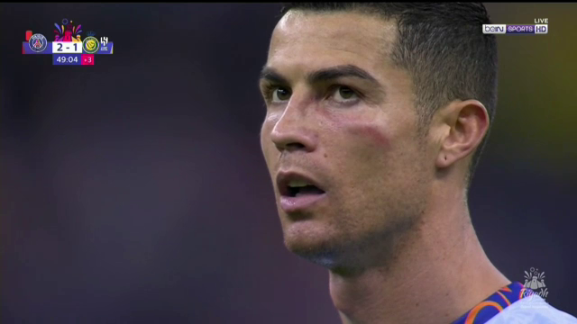 Cristiano Ronaldo, primele goluri în Arabia Saudită, după ce a fost învinețit de Keylor Navas: "Siuuu!"_21