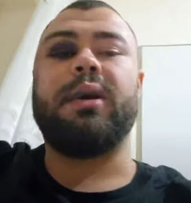 „Brutalitate extremă!” Românul care și-a desfigurat fața pentru 5.000 de euro la concursul de pălmuit a ajuns în presa internațională! Ce scriu spaniolii _10