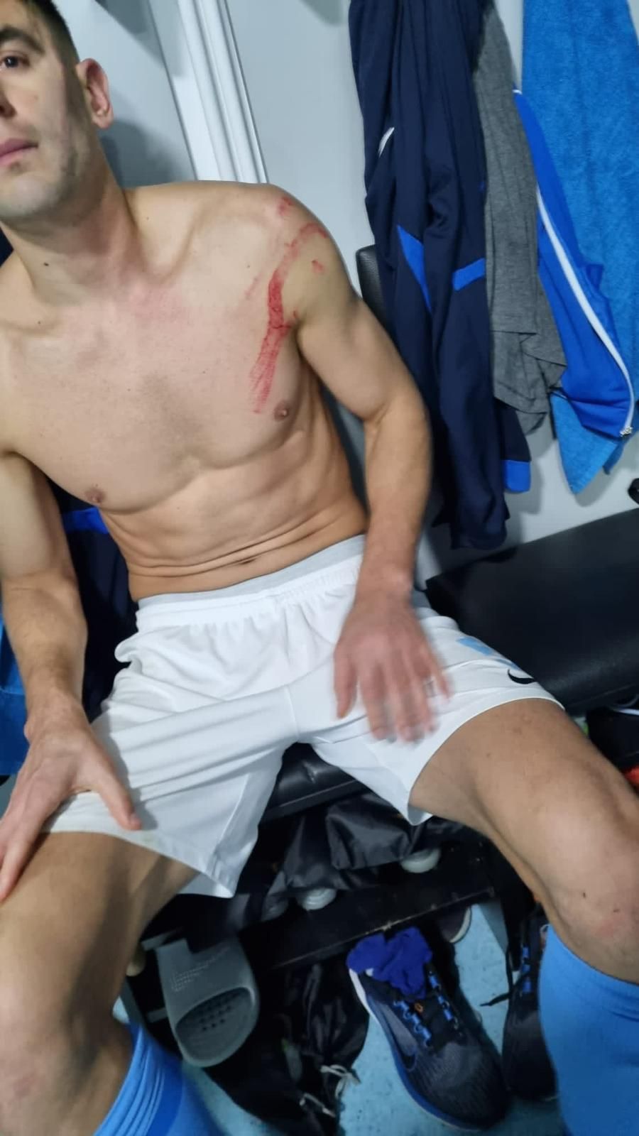 Imagini incredibile! Cum arată fața lui Igor Armaș după piciorul în cap primit de la Edjouma_3