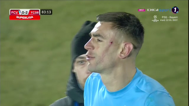 Imagini incredibile! Cum arată fața lui Igor Armaș după piciorul în cap primit de la Edjouma_5