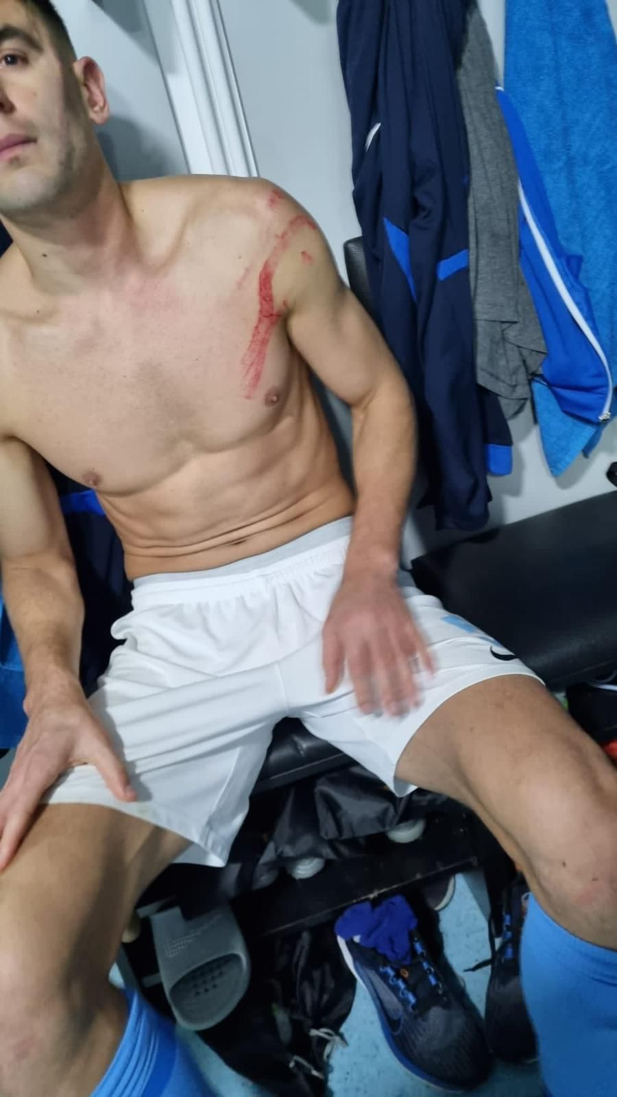 Cum arată acum Igor Armaș, după ce s-a ales cu răni vizibile după faultul dur al lui Edjouma_4