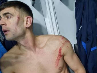 
	Cum arată acum Igor Armaș, după ce s-a ales cu răni vizibile după faultul dur al lui Edjouma
