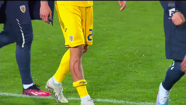 Dennis Man, 'avariat' în meciul cu Andorra! Cum arată la pauză piciorul marcatorului României _11
