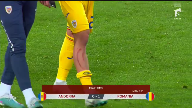 Dennis Man, 'avariat' în meciul cu Andorra! Cum arată la pauză piciorul marcatorului României _18