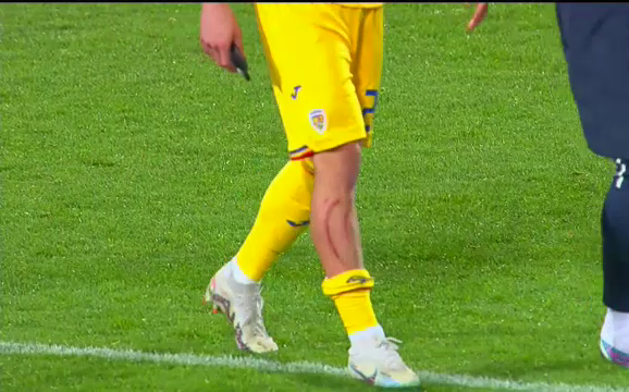 Dennis Man, 'avariat' în meciul cu Andorra! Cum arată la pauză piciorul marcatorului României _9