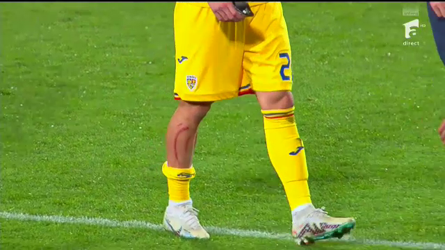Dennis Man, 'avariat' în meciul cu Andorra! Cum arată la pauză piciorul marcatorului României _10