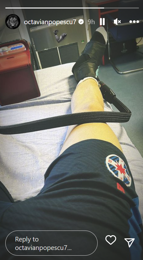 Cum arată glezna lui Tavi Popescu, după ce fotbalistul s-a accidentat în România - Belarus_2
