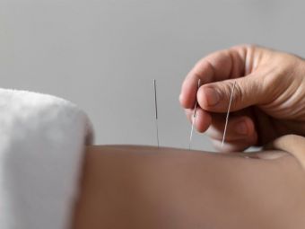 
	(P)&nbsp;Descoperind acupunctura: din antichitate pana la practica modernă
