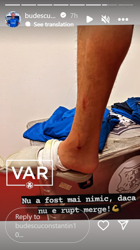 Cum arată piciorul lui Constantin Budescu după meciul cu CFR: ”Dacă nu e rupt, merge”_3