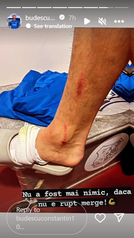 Cum arată piciorul lui Constantin Budescu după meciul cu CFR: ”Dacă nu e rupt, merge”_4