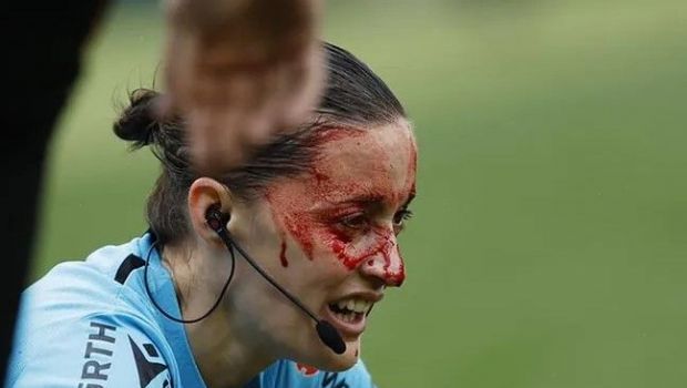 
	Arbitră plină de sânge în La Liga! Guadalupe Porras, transportată la spital după ce s-a lovit de o cameră TV în Betis Sevilla - Athletic Bilbao
