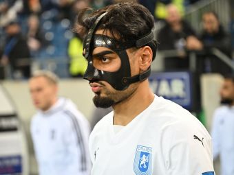 
	Masca lui Ștefan Baiaram. Fotbalistul Universității Craiova, dezvăluiri despre &#39;accesoriul&#39; pe care e obligat să-l poarte
